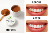 Teeth Whitening Powder